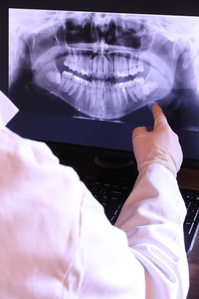 Best Emergency Root Canal Therapy in Amelia, LA