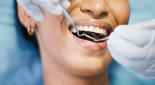 Best Lost Filling or Crown Replacement in Amelia, LA